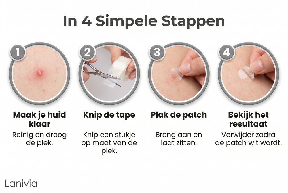 Clarité - in 4 simpele stappen